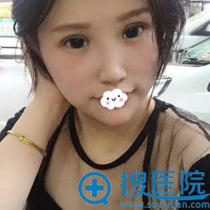 <!--<i data=20240710 data-id=12159></i>-->王全俊韩式翘睫双眼皮术后效果好吗 <!--<i data=20240710 data-id=12159></i>-->王全俊韩式翘睫双眼皮术后效果好吗