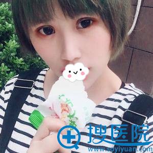 <!--<i data=20240710 data-id=12159></i>-->王全俊切开双眼双眼皮案例效果 <!--<i data=20240710 data-id=12159></i>-->王全俊切开双眼双眼皮案例效果