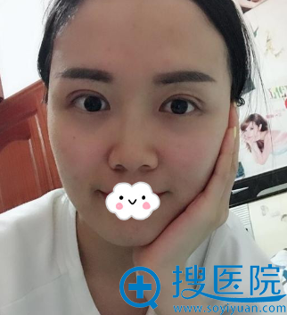 <!--<i data=20240710 data-id=12923></i>-->罗通贵双眼皮失败修复效果怎么样? <!--<i data=20240710 data-id=12923></i>-->罗通贵双眼皮失败修复效果怎么样?