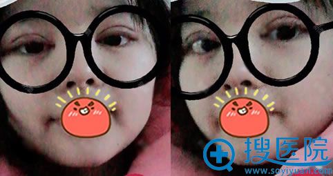 �人��������˫��Ƥ����Ч��