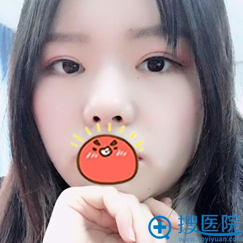 �人���γ¸�ʥ˫��Ƥ���۽ǰ���