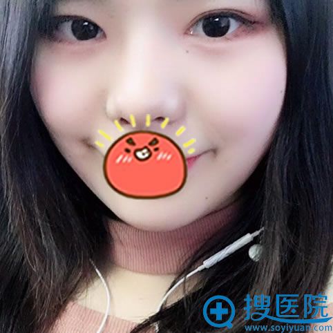 �人����˫��Ƥ�Ϳ��۽�3����Ч��