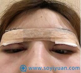 <!--<i data=20240710 data-id=9309></i>-->眼综合案例 <!--<i data=20240710 data-id=9309></i>-->眼综合案例