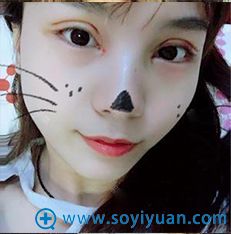 <!--<i data=20240710 data-id=9309></i>-->眼综合案例 <!--<i data=20240710 data-id=9309></i>-->眼综合案例