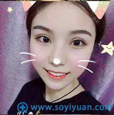 <!--<i data=20240710 data-id=9309></i>-->眼综合案例 <!--<i data=20240710 data-id=9309></i>-->眼综合案例