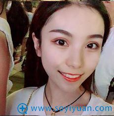 <!--<i data=20240710 data-id=9309></i>-->眼综合案例 <!--<i data=20240710 data-id=9309></i>-->眼综合案例