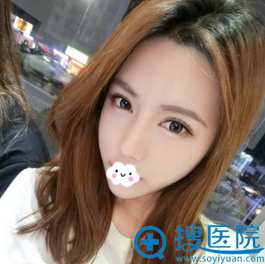 成都医美刘国权假体隆鼻综合整形术后效果好吗 成都医美刘国权假体隆鼻综合整形术后效果好吗