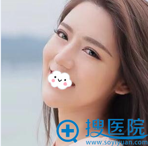 成都医美刘国权假体隆鼻+垫鼻尖+鼻翼缩小案例 成都医美刘国权假体隆鼻+垫鼻尖+鼻翼缩小案例