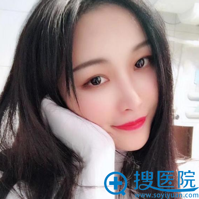 杭州甄美整形医院王辉隆鼻案例一个月效果 杭州甄美整形医院王辉隆鼻案例一个月效果