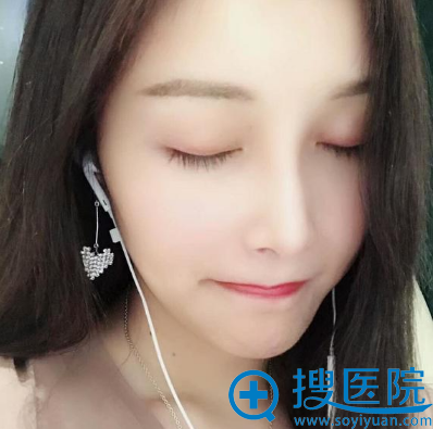 去杭州甄美整形医院找王辉做隆鼻子三个月了 去杭州甄美整形医院找王辉做隆鼻子三个月了