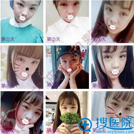 �����콨���п�˫��Ƥ+�����۽����˰����ָ�����ͼ