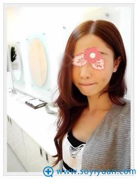 在洛阳华美做线雕手术前 在洛阳华美做线雕手术前