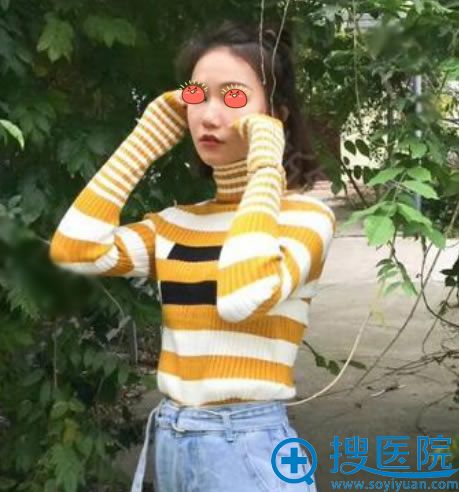 选择<!--<i data=20240710 data-id=10743></i>-->整形做隆鼻7天后 选择<!--<i data=20240710 data-id=10743></i>-->整形做隆鼻7天后