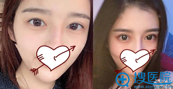 找重庆军美胡金香做双眼皮失败修复<span style= 找重庆军美胡金香做双眼皮失败修复<span style=