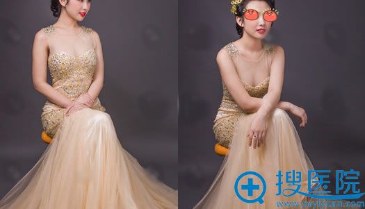 ѡ�����Ż����ֺ���¡��3���º�