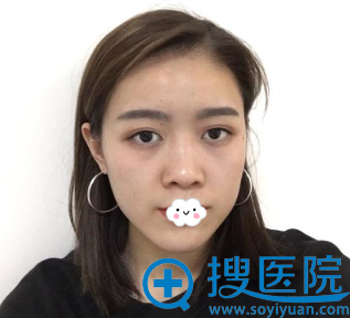 <!--<i data=20240710 data-id=10744></i>-->注射效果好吗?有真人案例吗? <!--<i data=20240710 data-id=10744></i>-->注射效果好吗?有真人案例吗?
