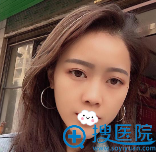 <!--<i data=20240710 data-id=10744></i>-->注射术后效果 <!--<i data=20240710 data-id=10744></i>-->注射术后效果