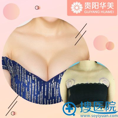 贵阳华美整形医院谢占军隆胸案例效果图 贵阳华美整形医院谢占军隆胸案例效果图