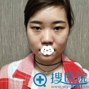�人����Ԫ����ǿ˫��Ƥ+¡�����˰���