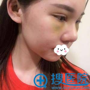 �人����Ԫ�۱�������ô��������ǿ˫��Ƥ+¡�ǰ���ͼ