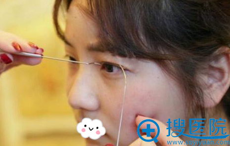 <!--<i data=20240710 data-id=12206></i>-->双眼皮效果怎么样?蒋翔峰切双眼皮真人案例 <!--<i data=20240710 data-id=12206></i>-->双眼皮效果怎么样?蒋翔峰切双眼皮真人案例