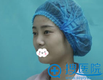 <!--<i data=20240710 data-id=9418></i>-->双眼皮+隆鼻效果怎么样? <!--<i data=20240710 data-id=9418></i>-->双眼皮+隆鼻效果怎么样?