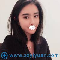 在深圳博爱许国明处割双眼皮+隆鼻+下巴整形术后效果 在深圳博爱许国明处割双眼皮+隆鼻+下巴整形术后效果