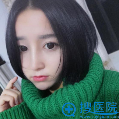 陈建华鼻综合隆鼻术后半个月效果图 陈建华鼻综合隆鼻术后半个月效果图