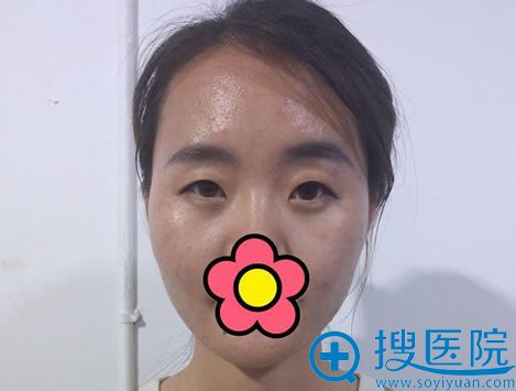 ������ʱ��������˫��Ƥǰ