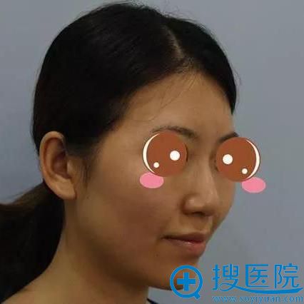 �ҵ������ռǣ�������ʱ����÷ע����������1�»ָ�Ч��ͼ��ô��