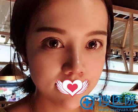 ��³ľ�뻪�����ۺ�¡�ǵ�15��ָ����