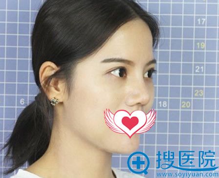����³ľ�뻪������ϼ�����ۺ������20��ָ�Ч��