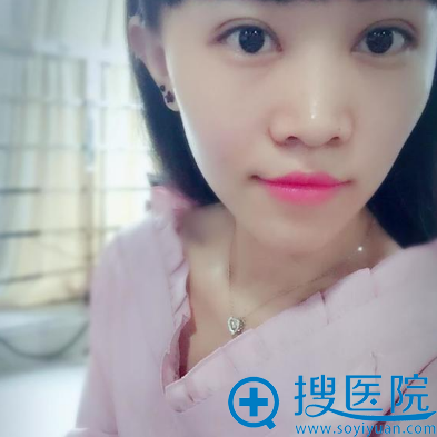 <!--<i data=20240710 data-id=10206></i>-->������������˫��Ƥ����������Ч��ͼ