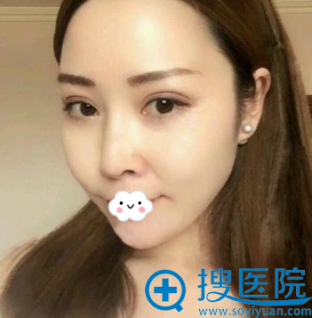 �����ļ�˫��Ƥ���κã�<!--<i data=20240710 data-id=12104></i>-->˫��Ƥ+ȥ�۴�����ͼ