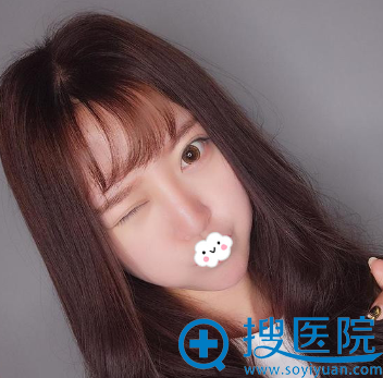 武汉米兰假体隆鼻效果怎么样? 武汉米兰假体隆鼻效果怎么样?