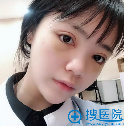 双眼皮术后半个月恢复情况 双眼皮术后半个月恢复情况