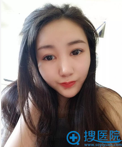 �����»�����<!--<i data=20240710 data-id=16723></i>-->˫��Ƥ��������7��