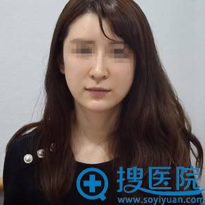 2年前被注射的生长因子终于在北京尚益嘉容黎星帮助下成功取出