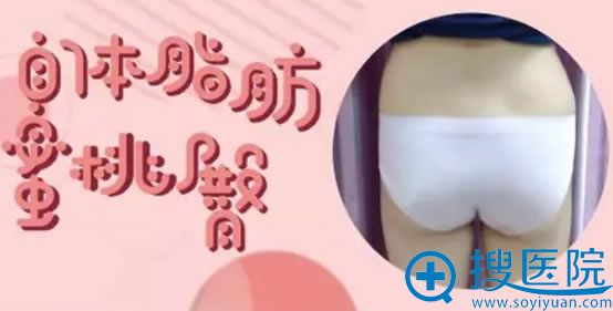 我在成都恒博医院参加9月优惠活动花8900元做自体脂肪丰臀