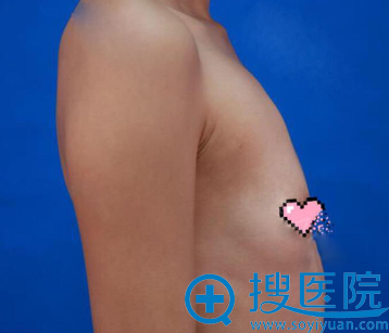 ֬�������Ͼ������Ľ�������������ٳ����¡������Ч���ָ�ͼ