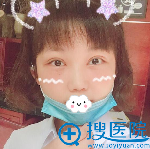 湖州曙光蔡茂季双眼皮术后真实恢复过程图 湖州曙光蔡茂季双眼皮术后真实恢复过程图