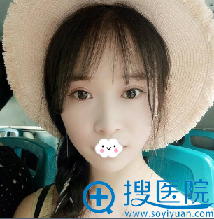 在<!--<i data=20240710 data-id=9146></i>-->张鹏处割双眼皮后真实恢复期图片 在<!--<i data=20240710 data-id=9146></i>-->张鹏处割双眼皮后真实恢复期图片