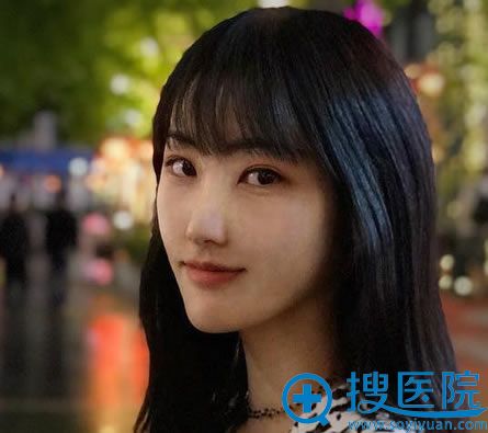直到面诊了做鼻子出名的北京华韩柳民熙医生才决定做鼻综合隆鼻