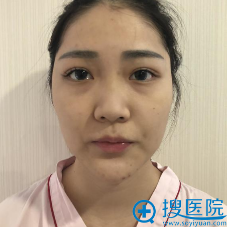 ����ҿ����һ�16000Ԫ���Ϻ��ٴ����������ı��ۺ�¡���ж���