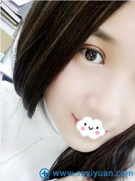 <!--<i data=20240710 data-id=12271></i>-->整形医院杨明锋双眼皮术后7天效果图 <!--<i data=20240710 data-id=12271></i>-->整形医院杨明锋双眼皮术后7天效果图