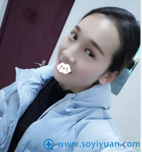 <!--<i data=20240710 data-id=12271></i>-->杨明锋双眼皮+开眼角案例效果图片 <!--<i data=20240710 data-id=12271></i>-->杨明锋双眼皮+开眼角案例效果图片