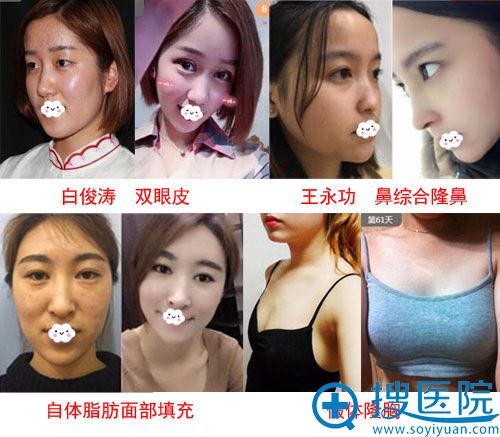 <!--<i data=20240710 data-id=12037></i>-->双眼皮、隆鼻、隆胸整形真人案例效果图 <!--<i data=20240710 data-id=12037></i>-->双眼皮、隆鼻、隆胸整形真人案例效果图