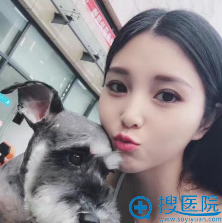 <!--<i data=20240710 data-id=12466></i>-->双眼皮术后15天 <!--<i data=20240710 data-id=12466></i>-->双眼皮术后15天
