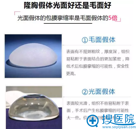 隆胸假体光面与假体材料区别 隆胸假体光面与假体材料区别