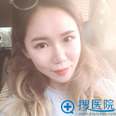 自体脂肪面部填充术后一个月 自体脂肪面部填充术后一个月